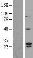 SNRPB2 Protein - Western validation with an anti-DDK antibody * L: Control HEK293 lysate R: Over-expression lysate