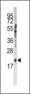 SNRPC / U1C Antibody - Western blot of anti-SNRPC Antibody in K562 cell line lysates (35 ug/lane). SNRPC(arrow) was detected using the purified antibody.