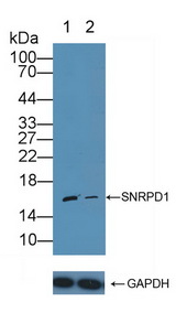SNRPD1 / SMD1 Antibody - Knockout Varification: Lane 1: Wild-type Jurkat cell lysate; Lane 2: SNRPD1 knockout Jurkat cell lysate; Predicted MW: 13kd Observed MW: 16kd Primary Ab: 1µg/ml Rabbit Anti-Human SNRPD1 Antibody Second Ab: 0.2µg/mL HRP-Linked Caprine Anti-Rabbit IgG Polyclonal Antibody