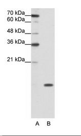 SNRPD1 / SMD1 Antibody - A: Marker, B: Jurkat Cell Lysate.  This image was taken for the unconjugated form of this product. Other forms have not been tested.