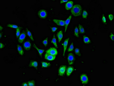 SNRPD1 / SMD1 Antibody - Immunofluorescent analysis of PC-3 cells using SNRPD1 Antibody at dilution of 1:100 and Alexa Fluor 488-congugated AffiniPure Goat Anti-Rabbit IgG(H+L)