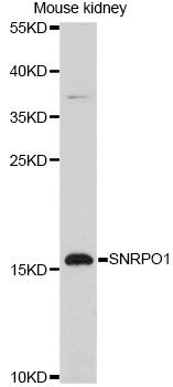 SNRPD1 / SMD1 Antibody - Western blot analysis of extracts of mouse kidney, using SNRPD1 antibody at 1:3000 dilution. The secondary antibody used was an HRP Goat Anti-Rabbit IgG (H+L) at 1:10000 dilution. Lysates were loaded 25ug per lane and 3% nonfat dry milk in TBST was used for blocking. An ECL Kit was used for detection and the exposure time was 90s.