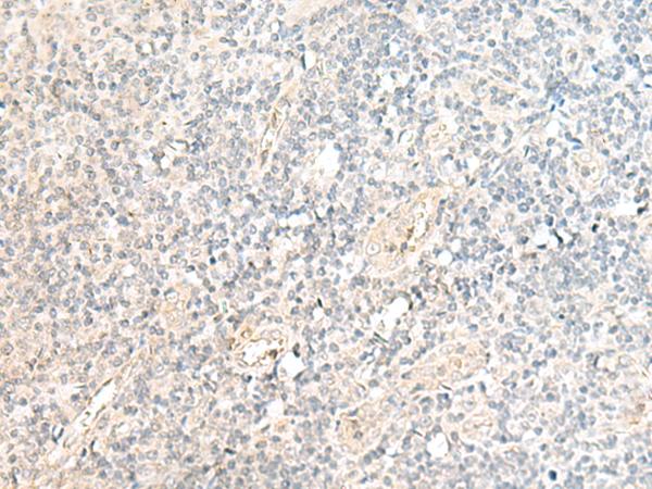 SNRPD1 / SMD1 Antibody - Immunohistochemistry of paraffin-embedded Human tonsil tissue  using SNRPD1 Polyclonal Antibody at dilution of 1:70(×200)