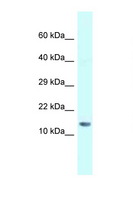 SNRPD1 / SMD1 Antibody - SNRPD1 antibody Western blot of Mouse Liver lysate. Antibody concentration 1 ug/ml.  This image was taken for the unconjugated form of this product. Other forms have not been tested.