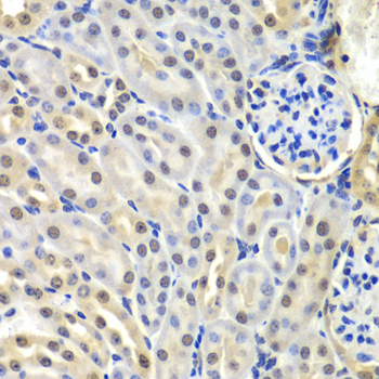 SNRPD2 Antibody - Immunohistochemistry of paraffin-embedded mouse kidney tissue.