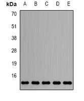 SNRPD2 Antibody - Western blot analysis of Sm-D2 expression in HepG2 (A); Jurkat (B); mouse testis (C); mouse heart (D); rat brain (E) whole cell lysates.