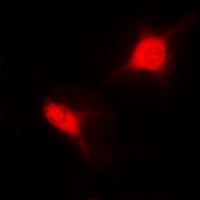 SNRPD2 Antibody - Immunofluorescent analysis of Sm-D2 staining in MCF7 cells. Formalin-fixed cells were permeabilized with 0.1% Triton X-100 in TBS for 5-10 minutes and blocked with 3% BSA-PBS for 30 minutes at room temperature. Cells were probed with the primary antibody in 3% BSA-PBS and incubated overnight at 4 deg C in a humidified chamber. Cells were washed with PBST and incubated with a DyLight 594-conjugated secondary antibody (red) in PBS at room temperature in the dark.