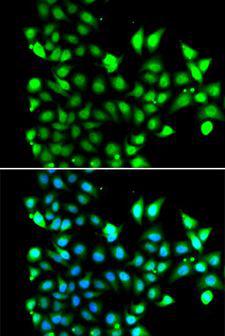SNRPD2 Antibody - Immunofluorescence analysis of MCF-7 cells using SNRPD2 antibody. Blue: DAPI for nuclear staining.