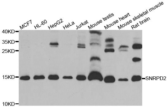 SNRPD2 Antibody - Western blot analysis of extracts of various cell lines, using SNRPD2 antibody at 1:1000 dilution. The secondary antibody used was an HRP Goat Anti-Rabbit IgG (H+L) at 1:10000 dilution. Lysates were loaded 25ug per lane and 3% nonfat dry milk in TBST was used for blocking. An ECL Kit was used for detection and the exposure time was 30s.
