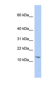 SNRPD2 Antibody - SNRPD2 antibody Western blot of Jurkat lysate. This image was taken for the unconjugated form of this product. Other forms have not been tested.