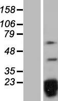 SNRPD2 Protein - Western validation with an anti-DDK antibody * L: Control HEK293 lysate R: Over-expression lysate