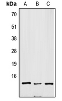 SNRPD3 Antibody - Western blot analysis of SNRPD3 expression in Jurkat (A); mouse brain (B); H9C2 (C) whole cell lysates.