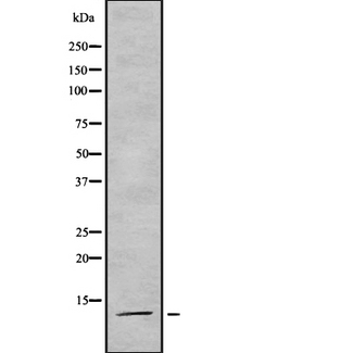 SNRPD3 Antibody - Western blot analysis SmD3 using LOVO cells whole cells lysates