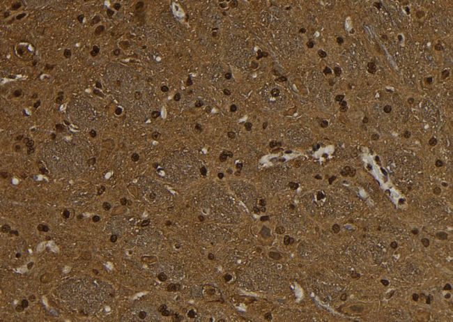 SNRPD3 Antibody - 1:100 staining rat brain tissue by IHC-P. The sample was formaldehyde fixed and a heat mediated antigen retrieval step in citrate buffer was performed. The sample was then blocked and incubated with the antibody for 1.5 hours at 22°C. An HRP conjugated goat anti-rabbit antibody was used as the secondary.
