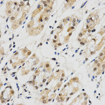 SNRPE Antibody - Immunohistochemistry of paraffin-embedded human stomach tissue.