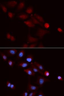 SNRPE Antibody - Immunofluorescence analysis of U20S cells.