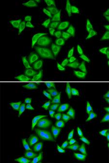 SNRPE Antibody - Immunofluorescence analysis of HeLa cells.