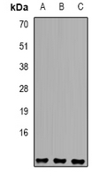SNRPE Antibody - Western blot analysis of Sm E expression in A549 (A); K562 (B); HepG2 (C) whole cell lysates.