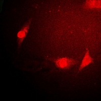SNRPE Antibody - Immunofluorescent analysis of Sm E staining in HeLa cells. Formalin-fixed cells were permeabilized with 0.1% Triton X-100 in TBS for 5-10 minutes and blocked with 3% BSA-PBS for 30 minutes at room temperature. Cells were probed with the primary antibody in 3% BSA-PBS and incubated overnight at 4 deg C in a humidified chamber. Cells were washed with PBST and incubated with a DyLight 594-conjugated secondary antibody (red) in PBS at room temperature in the dark.