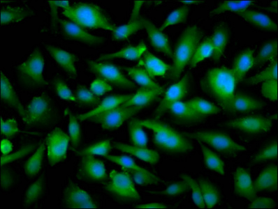 SNRPE Antibody - Immunofluorescence staining of U251 cells diluted at 1:66, counter-stained with DAPI. The cells were fixed in 4% formaldehyde, permeabilized using 0.2% Triton X-100 and blocked in 10% normal Goat Serum. The cells were then incubated with the antibody overnight at 4°C.The Secondary antibody was Alexa Fluor 488-congugated AffiniPure Goat Anti-Rabbit IgG (H+L).