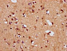 SNRPE Antibody - Immunohistochemistry Dilution at 1:200 and staining in paraffin-embedded human brain tissue performed on a Leica BondTM system. After dewaxing and hydration, antigen retrieval was mediated by high pressure in a citrate buffer (pH 6.0). Section was blocked with 10% normal Goat serum 30min at RT. Then primary antibody (1% BSA) was incubated at 4°C overnight. The primary is detected by a biotinylated Secondary antibody and visualized using an HRP conjugated SP system.