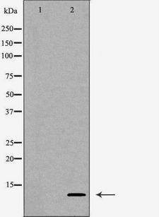 SNRPE Antibody - Western blot analysis of HepG2 whole cells lysates using SNRPE antibody. The lane on the left is treated with the antigen-specific peptide.