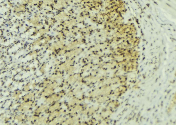 SNRPE Antibody - 1:100 staining human gastric tissue by IHC-P. The sample was formaldehyde fixed and a heat mediated antigen retrieval step in citrate buffer was performed. The sample was then blocked and incubated with the antibody for 1.5 hours at 22°C. An HRP conjugated goat anti-rabbit antibody was used as the secondary.