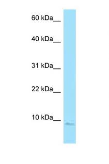 SNRPE Antibody - SNRPE antibody Western blot of 721_B Cell lysate. Antibody concentration 1 ug/ml.  This image was taken for the unconjugated form of this product. Other forms have not been tested.