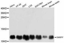 SNRPF Antibody - Western blot analysis of extracts of various cell lines, using SNRPF antibody at 1:3000 dilution. The secondary antibody used was an HRP Goat Anti-Rabbit IgG (H+L) at 1:10000 dilution. Lysates were loaded 25ug per lane and 3% nonfat dry milk in TBST was used for blocking. An ECL Kit was used for detection and the exposure time was 1s.