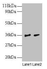 SNRPG Antibody - Western blot All lanes: Small nuclear ribonucleoprotein G antibody at 2µg/ml Lane 1: EC109whole cell lysate Lane 2: 293T whole cell lysate Secondary Goat polyclonal to rabbit IgG at 1/15000 dilution Predicted band size: 8.4 kDa Observed band size: 36 kDa