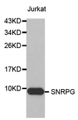 SNRPG Antibody - Western blot analysis of extracts of Jurkat cell lines.