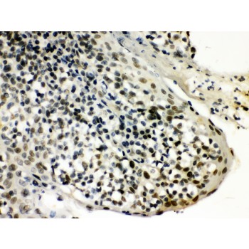 SNRPN Antibody - SNRPN antibody IHC-paraffin. IHC(P): Human Tonsil Tissue.
