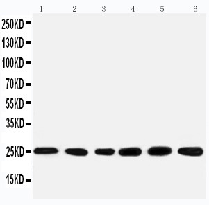 SNRPN Antibody - WB of SNRPN antibody. All lanes: Anti-SNRPN at 0.5ug/ml. Lane 1: Rat kidney Tissue Lysate at 40ug. Lane 2: U87 Whole Cell Lysate at 40ug. Lane 3: U87 Whole Cell Lysate at 40ug. Lane 4: HELA Whole Cell Lysate at 40ug. Lane 5: HMY Whole Cell Lysate at 40ug. Lane 6: NEUR Whole Cell Lysate at 40ug. Predicted bind size: 25KD. Observed bind size: 25KD.