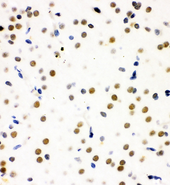 SNRPN Antibody - IHC analysis of SNRPN using anti-SNRPN antibody. SNRPN was detected in paraffin-embedded section of rat brain tissue. Heat mediated antigen retrieval was performed in citrate buffer (pH6, epitope retrieval solution) for 20 mins. The tissue section was blocked with 10% goat serum. The tissue section was then incubated with 1µg/ml rabbit anti-SNRPN Antibody overnight at 4°C. Biotinylated goat anti-rabbit IgG was used as secondary antibody and incubated for 30 minutes at 37°C. The tissue section was developed using Strepavidin-Biotin-Complex (SABC) with DAB as the chromogen.