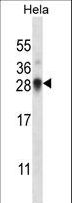 SNRPN Antibody - SNRPN Antibody western blot of HeLa cell line lysates (35 ug/lane). The SNRPN antibody detected the SNRPN protein (arrow).