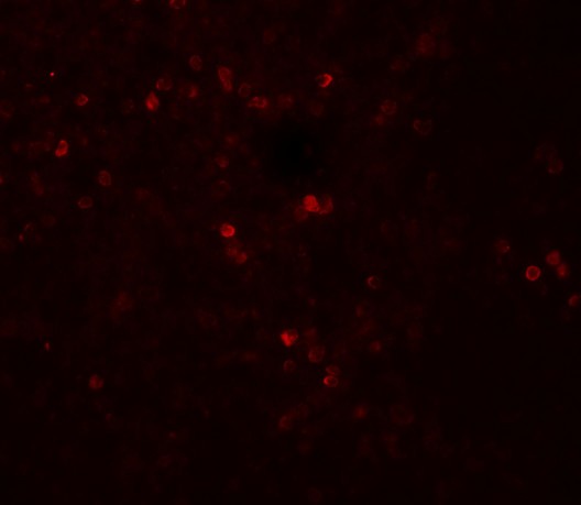 SNRPN Antibody - Immunofluorescence of SNRPN in human spleen tissue with SNRPN antibody at 20 ug/mL.