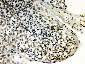 SNRPN Antibody