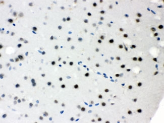 SNRPN Antibody