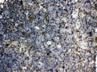 SNRPN Antibody