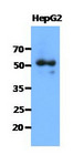 SNTA1 / Syntrophin Alpha 1 Antibody - Western Blot: The cell lysates of HepG2 (40 ug) were resolved by SDS-PAGE, transferred to PVDF membrane and probed with anti-human SNTA1 antibody (1:1000). Proteins were visualized using a goat anti-mouse secondary antibody conjugated to HRP and an ECL detection system.