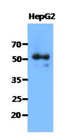 SNTA1 / Syntrophin Alpha 1 Antibody - Western Blot: The cell lysates of HepG2 (40 ug) were resolved by SDS-PAGE, transferred to PVDF membrane and probed with anti-human SNTA1 antibody (1:1000). Proteins were visualized using a goat anti-mouse secondary antibody conjugated to HRP and an ECL detection system.