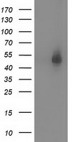 SNTA1 / Syntrophin Alpha 1 Antibody - HEK293T cells were transfected with the pCMV6-ENTRY control (Left lane) or pCMV6-ENTRY SNTA1 (Right lane) cDNA for 48 hrs and lysed. Equivalent amounts of cell lysates (5 ug per lane) were separated by SDS-PAGE and immunoblotted with anti-SNTA1.