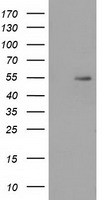 SNTA1 / Syntrophin Alpha 1 Antibody - HEK293T cells were transfected with the pCMV6-ENTRY control (Left lane) or pCMV6-ENTRY SNTA1 (Right lane) cDNA for 48 hrs and lysed. Equivalent amounts of cell lysates (5 ug per lane) were separated by SDS-PAGE and immunoblotted with anti-SNTA1.