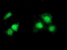 SNTA1 / Syntrophin Alpha 1 Antibody - Anti-SNTA1 mouse monoclonal antibody immunofluorescent staining of COS7 cells transiently transfected by pCMV6-ENTRY SNTA1.