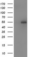 SNTA1 / Syntrophin Alpha 1 Antibody - HEK293T cells were transfected with the pCMV6-ENTRY control (Left lane) or pCMV6-ENTRY SNTA1 (Right lane) cDNA for 48 hrs and lysed. Equivalent amounts of cell lysates (5 ug per lane) were separated by SDS-PAGE and immunoblotted with anti-SNTA1.