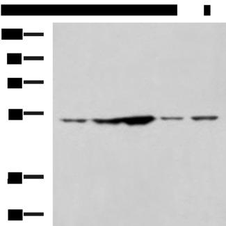 SNTA1 / Syntrophin Alpha 1 Antibody - Western blot analysis of 293T and Jurkat cell lysates  using SNTA1 Polyclonal Antibody at dilution of 1:1350
