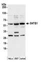 SNTB1 / A1B Antibody - Detection of human SNTB1 by western blot. Samples: Whole cell lysate (50 µg) from HeLa, HEK293T, and Jurkat cells prepared using NETN lysis buffer. Antibody: Affinity purified rabbit anti-SNTB1 antibody used for WB at 0.1 µg/ml. Detection: Chemiluminescence with an exposure time of 3 minutes.