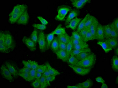 SNTB1 / A1B Antibody - Immunofluorescence staining of HepG2 cells diluted at 1:66, counter-stained with DAPI. The cells were fixed in 4% formaldehyde, permeabilized using 0.2% Triton X-100 and blocked in 10% normal Goat Serum. The cells were then incubated with the antibody overnight at 4°C.The Secondary antibody was Alexa Fluor 488-congugated AffiniPure Goat Anti-Rabbit IgG (H+L).