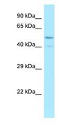 SNTB2 Antibody - SNTB2 antibody Western Blot of Fetal Small Intestine.  This image was taken for the unconjugated form of this product. Other forms have not been tested.