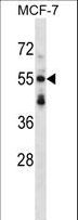 SNTB2 Antibody - SNTB2 Antibody western blot of MCF-7 cell line lysates (35 ug/lane). The SNTB2 antibody detected the SNTB2 protein (arrow).